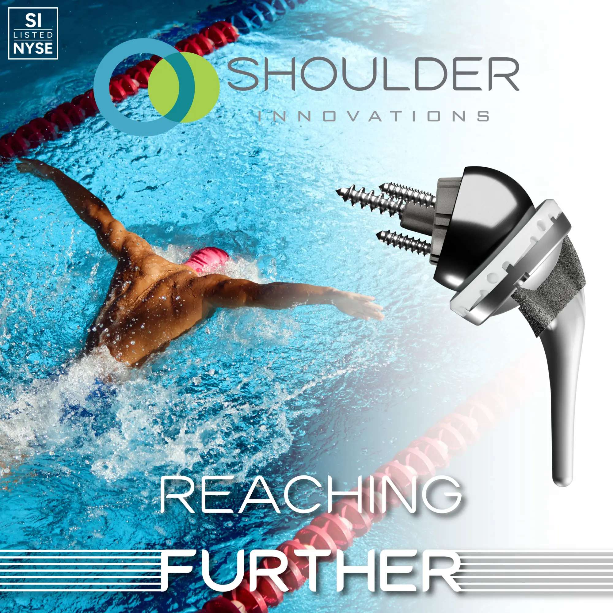 Shoulder Innovations reaching further swimmer RSA