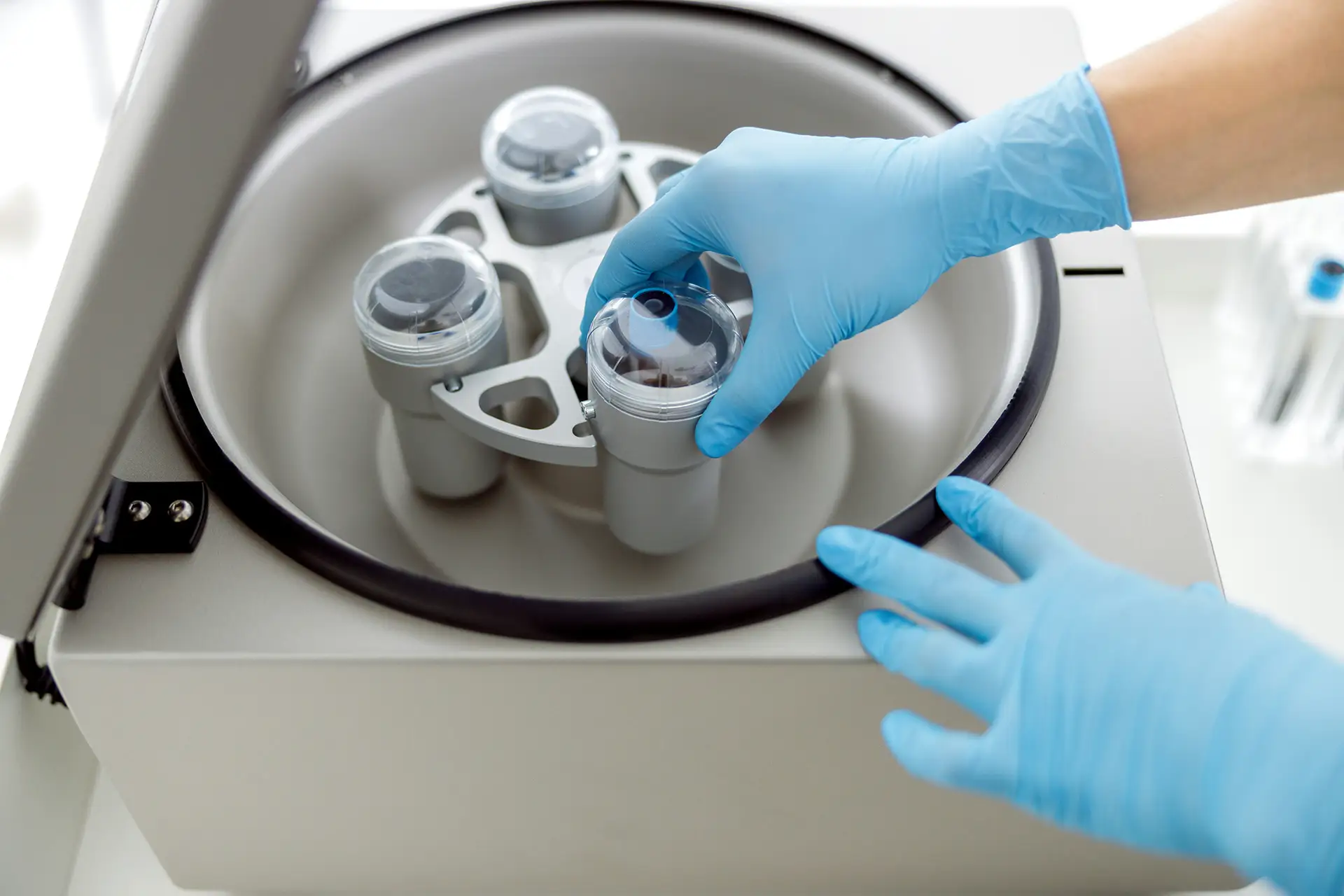 How Does PRP Work
