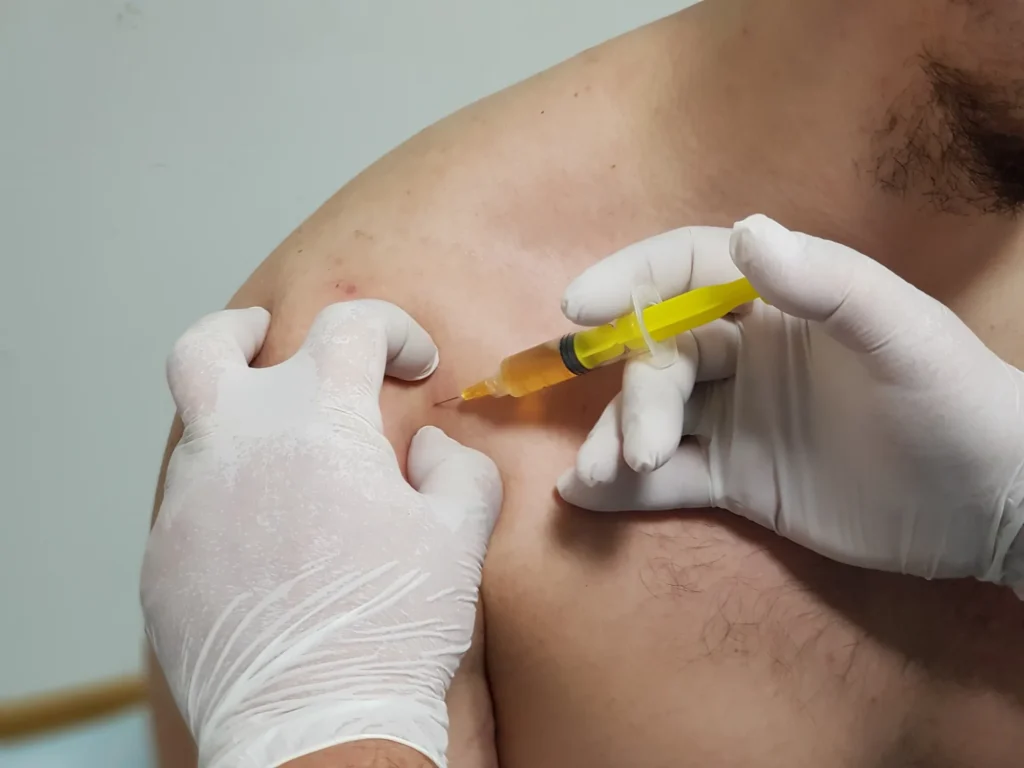 Surgeon giving their patient PRP shoulder injections for pain relief.