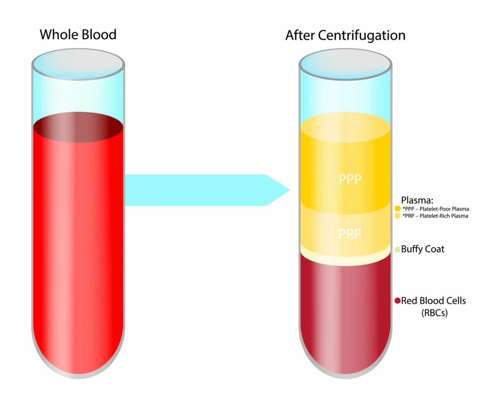 PRP process diagram.