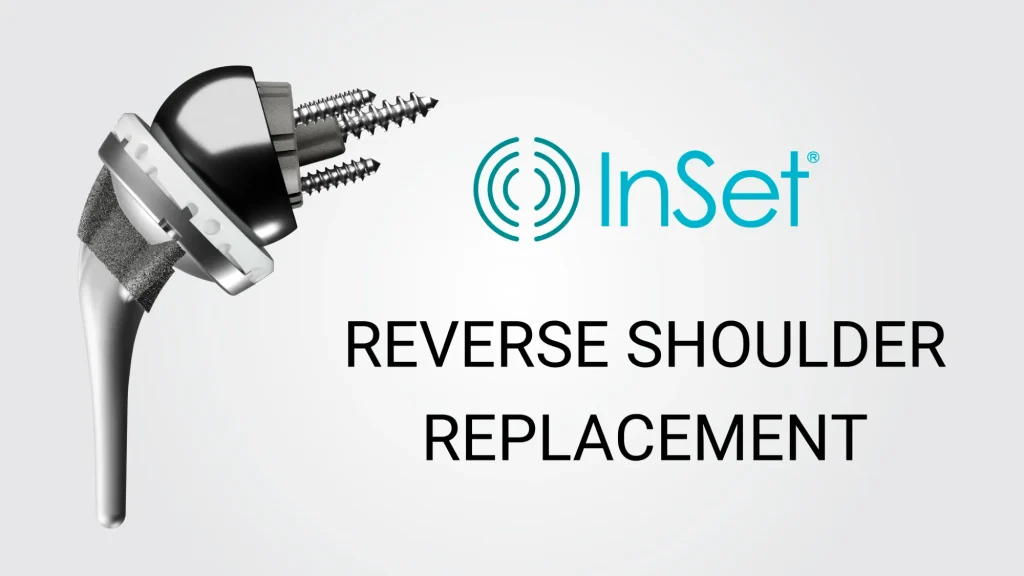 Diagram of reverse shoulder replacement 